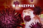 サル痘、パンデミックの可能性は? 日本で感染はあり得るのか?