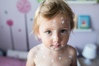 天然痘,トウシル