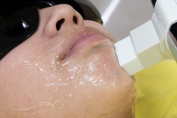 男性用医療脱毛の「ウルフクリニック」破産　急成長後の破局劇