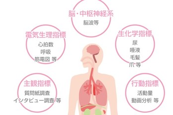 大学発ベンチャーの「起源」(78)　イヴケア