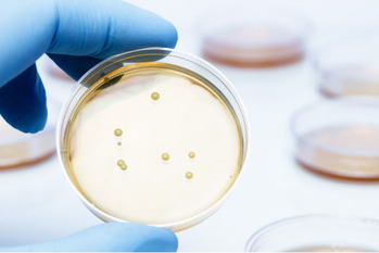 病気,免疫力,乳酸菌