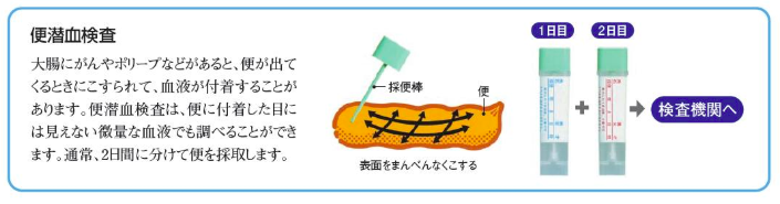 便潜血検査