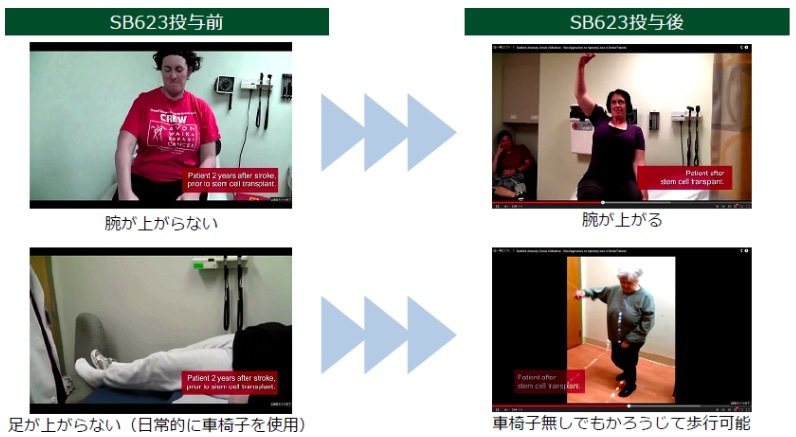 SB623」の効能