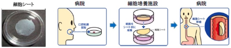 食道再生上皮シート(CLS2702C/D)